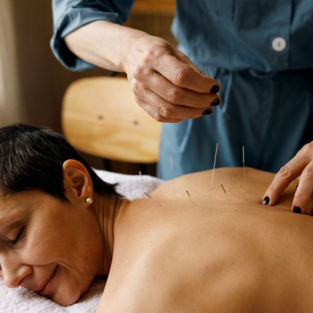 A person lying face down for acupuncture