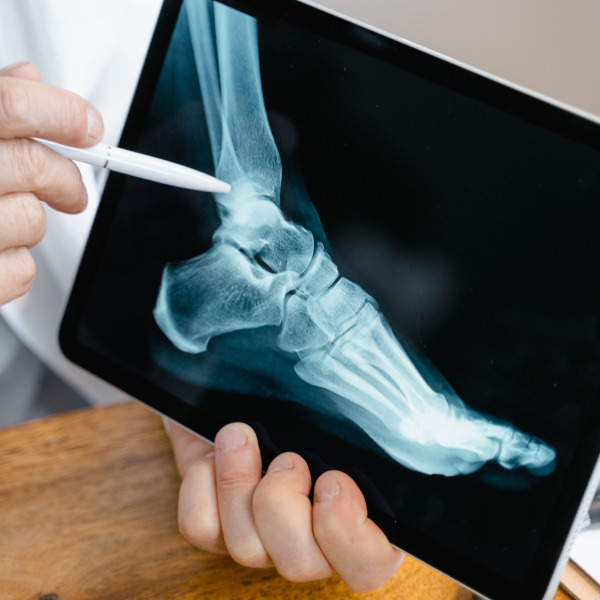 Podiatrist examining a foot x-ray on a tablet