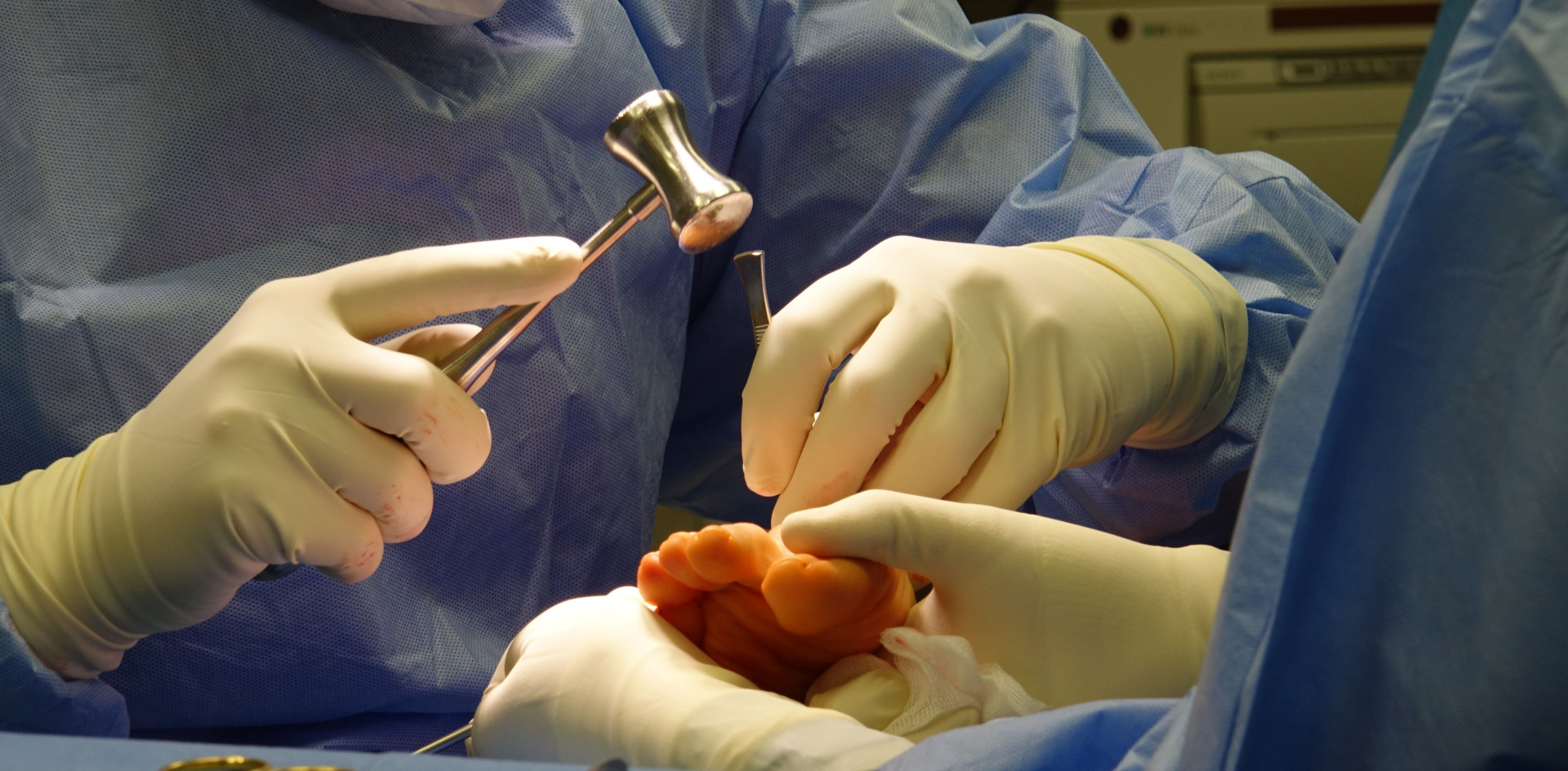 Surgical team performing a foot procedure in a sterile environment