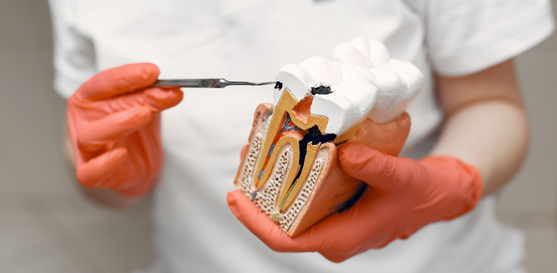 A dentist holding a teeth model