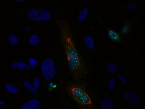 Microscopy image taken by Soka Class of 2025 undergraduate Rika Watanabe of reflectin proteins expressed within HeLa cells.